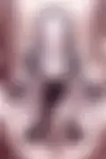 잠긴 이미지